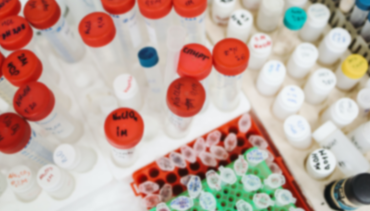 瓶胚的成型是怎样的？生产工艺又是怎样的？